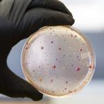 Ešerihija Koli – E. coli