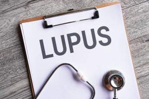 Šta je lupus i kako se leči